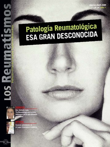 ENTREVISTA Dra. EstÃ­baliz Loza - Sociedad EspaÃ±ola de ...