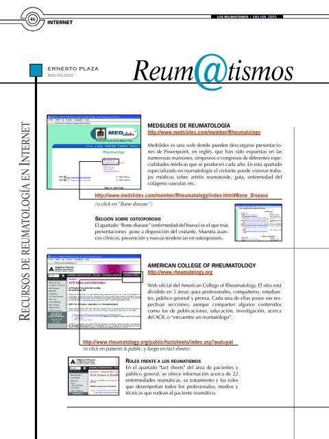 Entrevista D. JesÃºs Pedroche - Sociedad EspaÃ±ola de ReumatologÃ­a