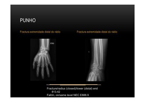 Diferentes visões do trauma e a sua codificação - Ortopedia