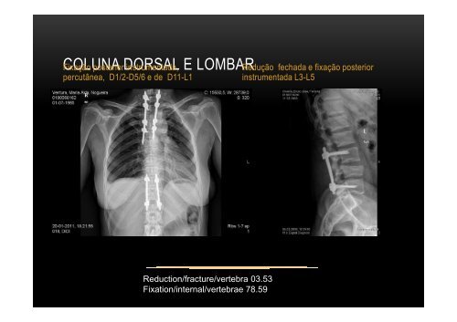 Diferentes visões do trauma e a sua codificação - Ortopedia