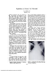 Papilledema in Chronic Cor Pulmonale