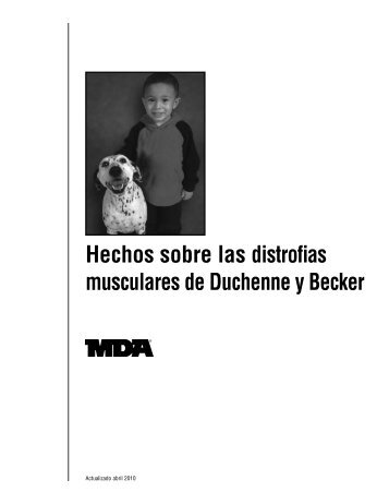 Hechos sobre las distrofias musculares de Duchenne y Becker - MDA