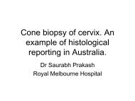 Cone biopsy of cervix - Rcpa.tv
