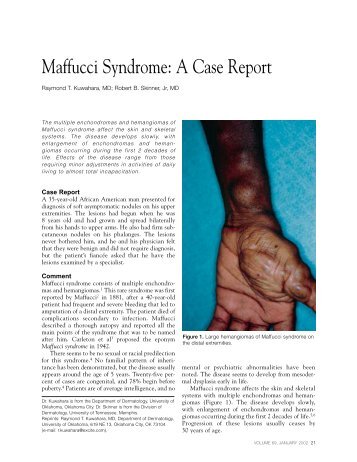 Maffucci Syndrome: A Case Report