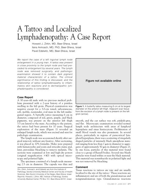 A Tattoo and Localized Lymphadenopathy: A Case ... - Ob.Gyn. News