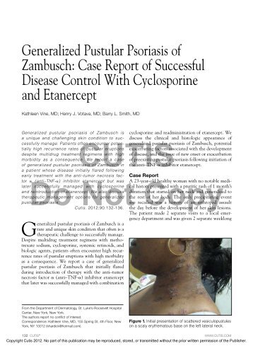 Generalized Pustular Psoriasis of Zambusch: Case ... - Ob.Gyn. News
