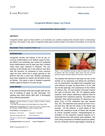 Congenital Median Upper Lip Fistula - APSP Journal of Case Reports