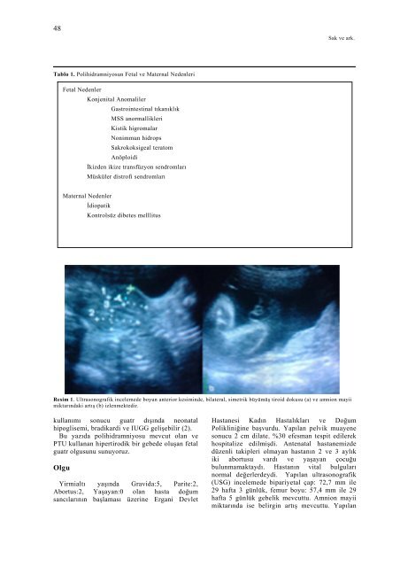 Ä°ntrauterin fetal guatr - TÄ±p AraÅtÄ±rmalarÄ± Dergisi