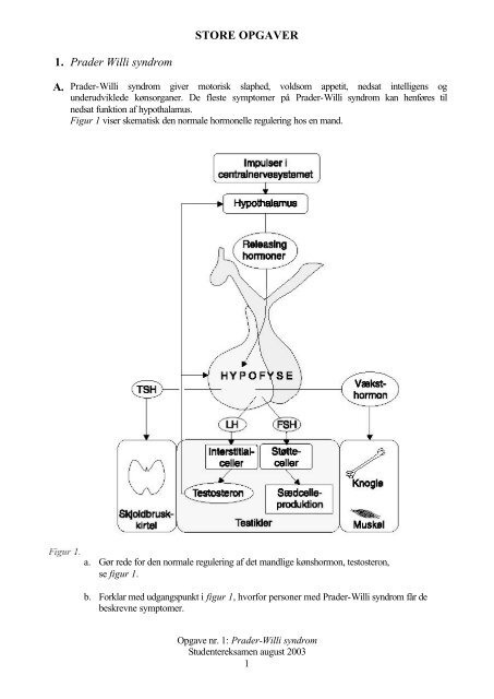 STORE OPGAVER 1. Prader Willi syndrom