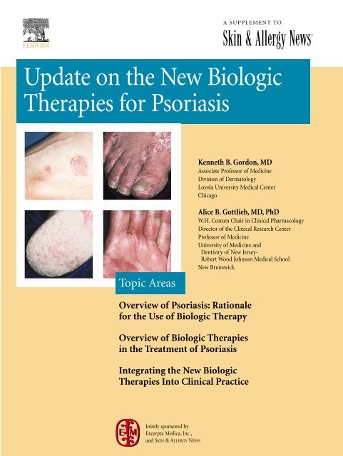 Overview Of Psoriasis - Global Academy for Medical Education