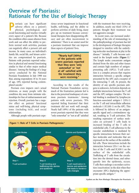 Overview Of Psoriasis - Global Academy for Medical Education