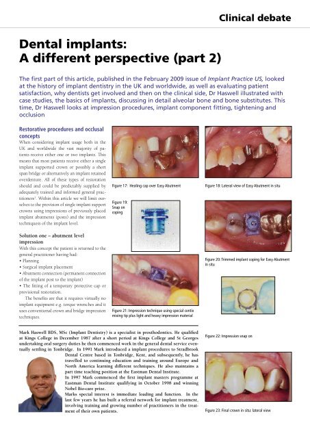 Dental implants: A different perspective (part 2) - Nobel Biocare