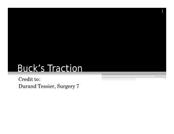 Buck's Traction