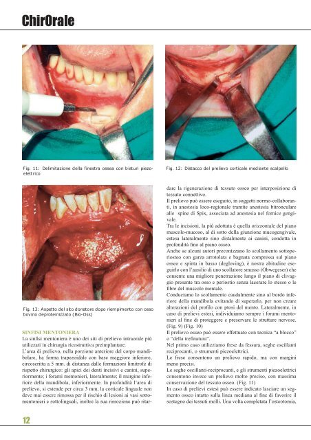 denti e dentisti nell'antica roma - Dentistaitaliano.it