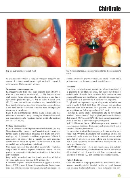 denti e dentisti nell'antica roma - Dentistaitaliano.it