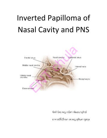 Inverted Papilloma of Nasal Cavity and PNS