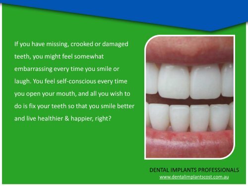 Affordable and High Quality Dental Implants in Sydney & Melbourne