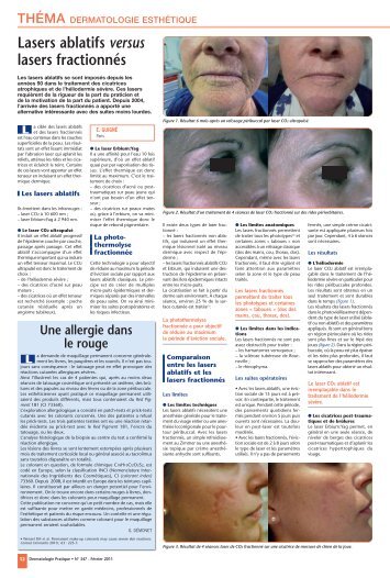 Lasers ablatifs versus lasers fractionnÃ©s - NF-Diffusion