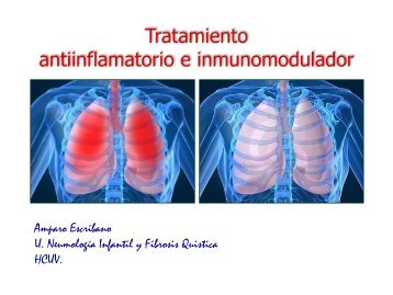 Tratamiento antiinflamatorio e inmunomodulador
