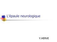 L'Ã©paule neurologique - sofomec