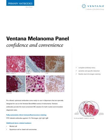 Melanoma Panel brochure - Ventana Medical Systems