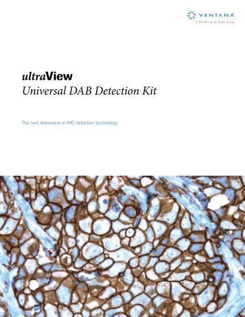 ultraView Universal DAB Detection Kit - Ventana Medical Systems