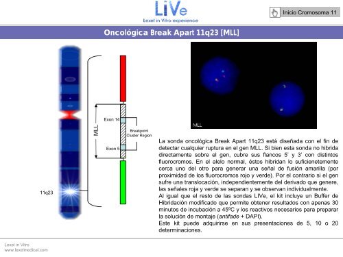 Doble FusiÃ³n t(4;11) - Lexel