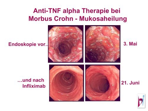 5 mg/kg Woche 0 Woche 2 Woche 6 Start