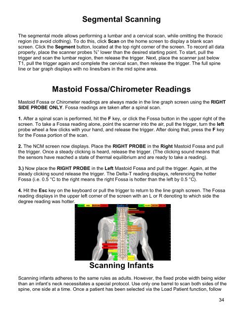 Titronics Tytron String Drawing.pdf Segmental Scanning The se