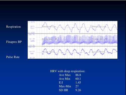 HRV in Autonomic Assessment - PhysioNet