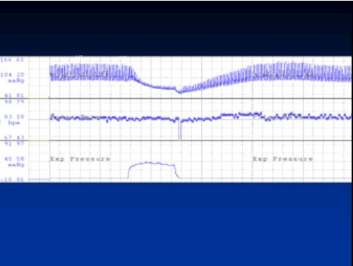 HRV in Autonomic Assessment - PhysioNet