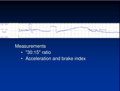 HRV in Autonomic Assessment - PhysioNet