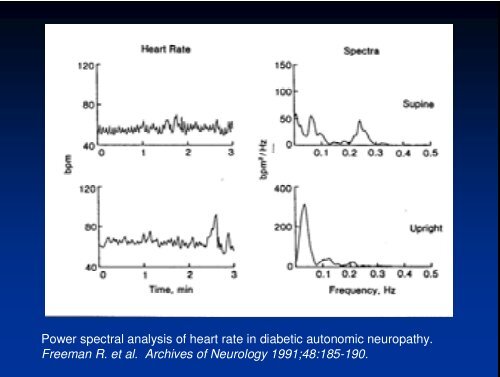 HRV in Autonomic Assessment - PhysioNet