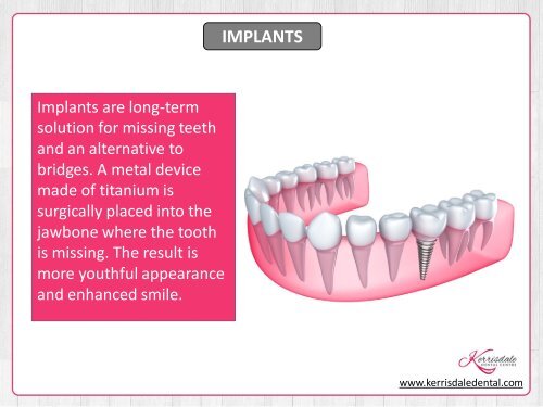 About Cosmetic Dentistry in Vancouver