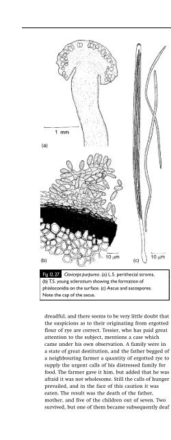 Introduction to Fungi, Third Edition