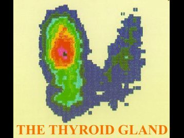 Thyroid gland