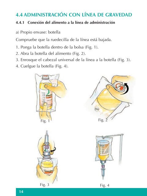 manual de nutriciÃ³n por sonda para el paciente - EXTRANET ...