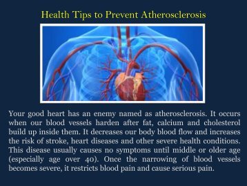 Health Tips to Prevent Atherosclerosis