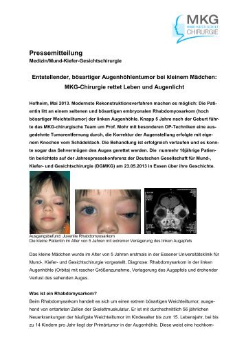 MKG-Chirurgie rettet Leben und Augenlicht - Patienteninformation ...