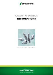 Crown and Bridge RESTORATIONS - Straumann