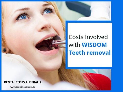 How Much Does It Cost To Get Wisdom Teeth Removed