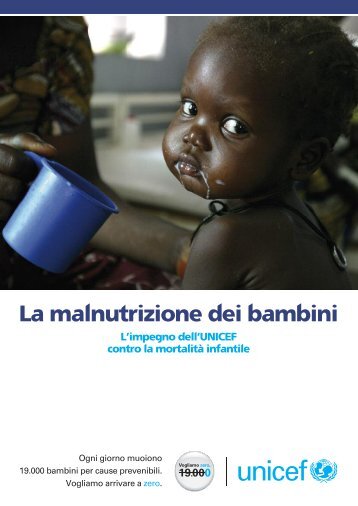 La malnutrizione dei bambini - Unicef