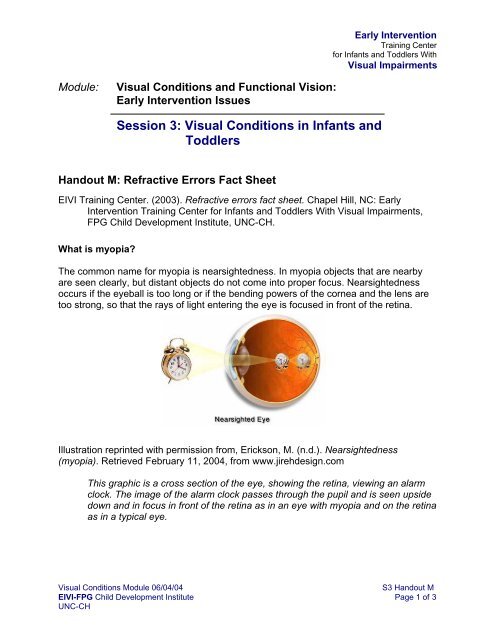 Refractive Errors Fact Sheet - Mount Sinai Hospital