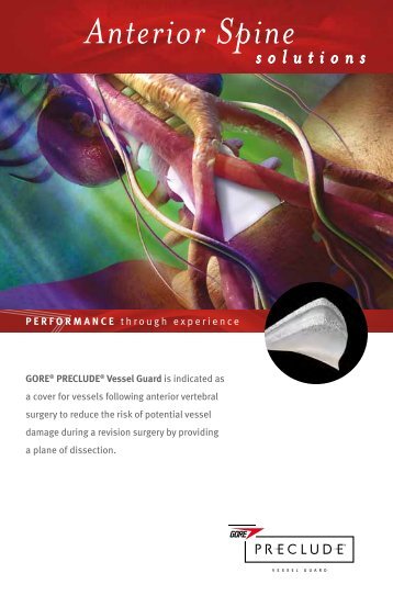 Anterior Spine Solutions - Gore Medical