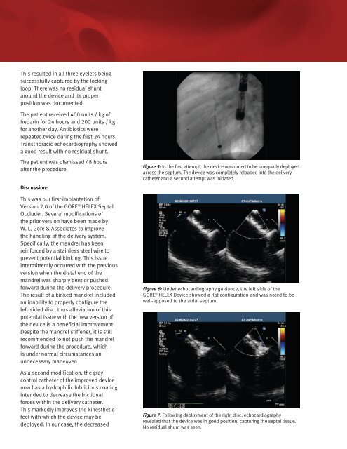 Printable PDF Version - Gore Medical