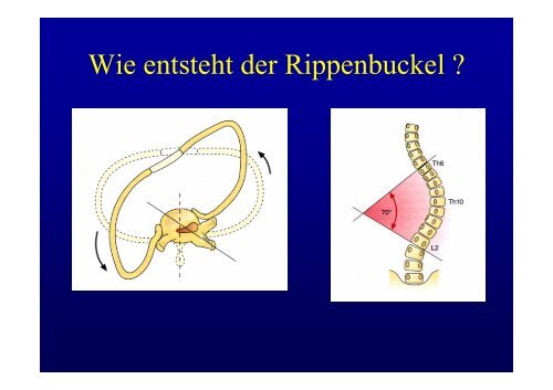 WirbelsÃ¤ule Diagnostik und Therapie Christoph H ... - fsrmed.de