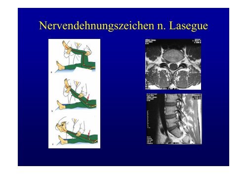 WirbelsÃ¤ule Diagnostik und Therapie Christoph H ... - fsrmed.de