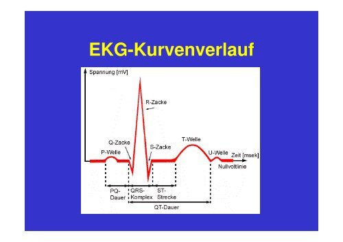 Ablauf akuter Myokardinfarkt