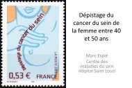 DÃ©pistage et cancer du sein de la femme avant 50 ans ... - ESKA