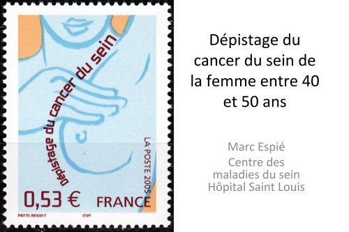 DÃ©pistage et cancer du sein de la femme avant 50 ans ... - ESKA